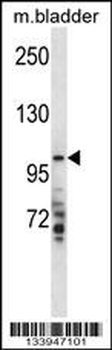 TMPRSS7 Antibody (N-term)