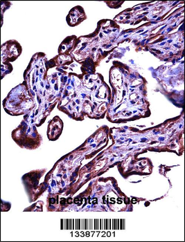 CEACAM3 Antibody (C-term)