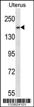 SMC1B Antibody (Center)