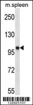 POLR3B Antibody (N-term)