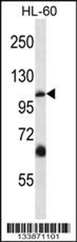 TRPC5 Antibody (N-term)