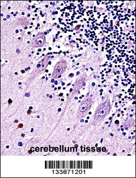 TRPC5 Antibody (N-term)