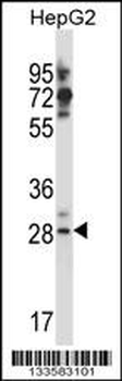 GSG1L Antibody (C-term)