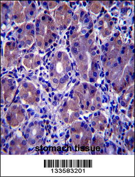 GSG1L Antibody (C-term)