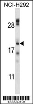 TMEM17 Antibody (N-term)