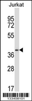 PAQR6 Antibody (C-term)