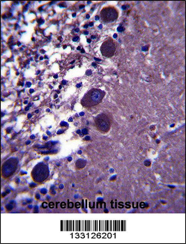 KCNK18 Antibody (Center)