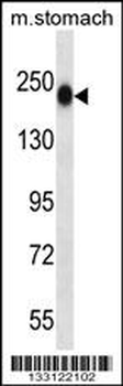 TNN Antibody (Center)