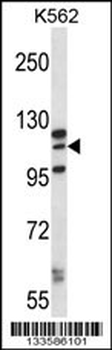 MORC1 Antibody (C-term)