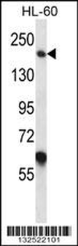 MYOM1 Antibody (Center)