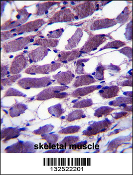 MYOM1 Antibody (Center)