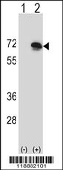BLNK Antibody (N-term)