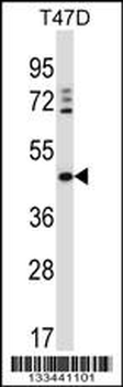 DEGS1 Antibody (N-term)