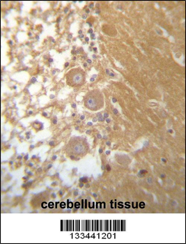 DEGS1 Antibody (N-term)