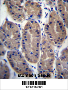 FRMD7 Antibody (N-term)