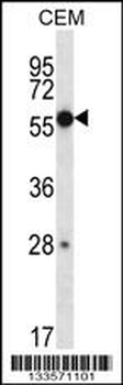 ZNF764 Antibody (Center)