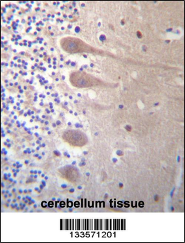 ZNF764 Antibody (Center)