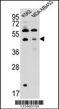 SNX29 Antibody (C-term)