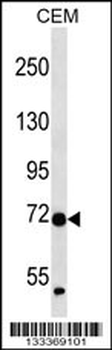 ZNF443 Antibody (N-term )