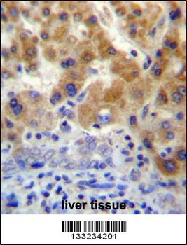 NT5C3L Antibody (N-term)