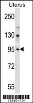 LRRC37B Antibody (C-term)