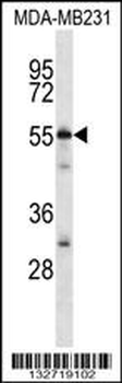 CG025 Antibody (N-term)