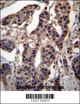 CG025 Antibody (N-term)