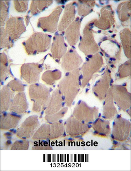 PACS2 Antibody (C-term)