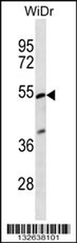 PIGV Antibody (C-term)