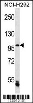 CHTF18 Antibody (C-term)