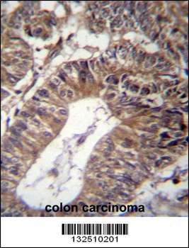 GCC1 Antibody (C-term)