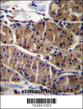 LRSAM1 Antibody (N-term)