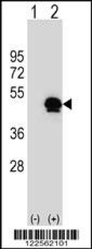 SERPINE1 Antibody (Center)