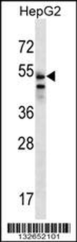 SLC29A3 Antibody (N-term)