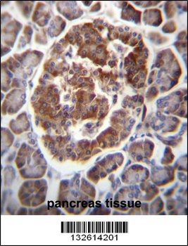 TBC1D22A Antibody (C-term)