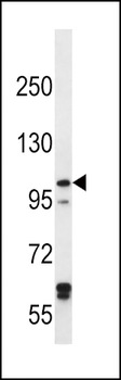 IREB2 Antibody (Center)
