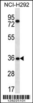TSGA13 Antibody (C-term)