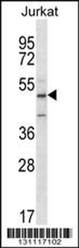 ABI2 Antibody (N-term)
