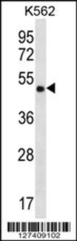 CCDC71 Antibody (C-term)