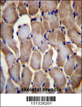 SEPN1 Antibody (C-term)