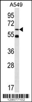 ZNF248 Antibody (Center)
