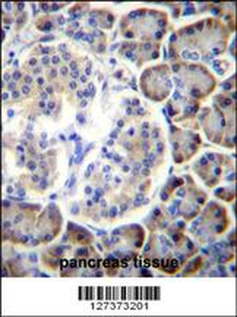 SMAP2 Antibody (Center)