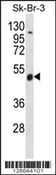 WDR34 Antibody (Center)