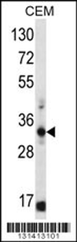 FFAR1 Antibody (C-term)