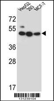LIPJ Antibody (Center)