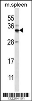FOXI2 Antibody (Center)