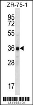CCNYL2 Antibody (Center)
