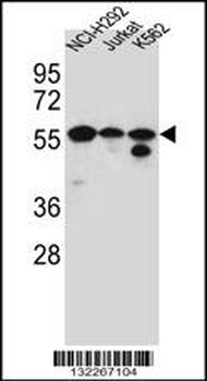 FOXN2 Antibody (N-term)