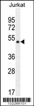 SNIP1 Antibody (N-term)