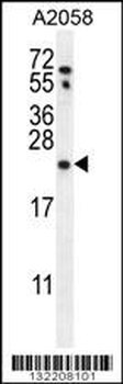 RAB10 Antibody (Center)